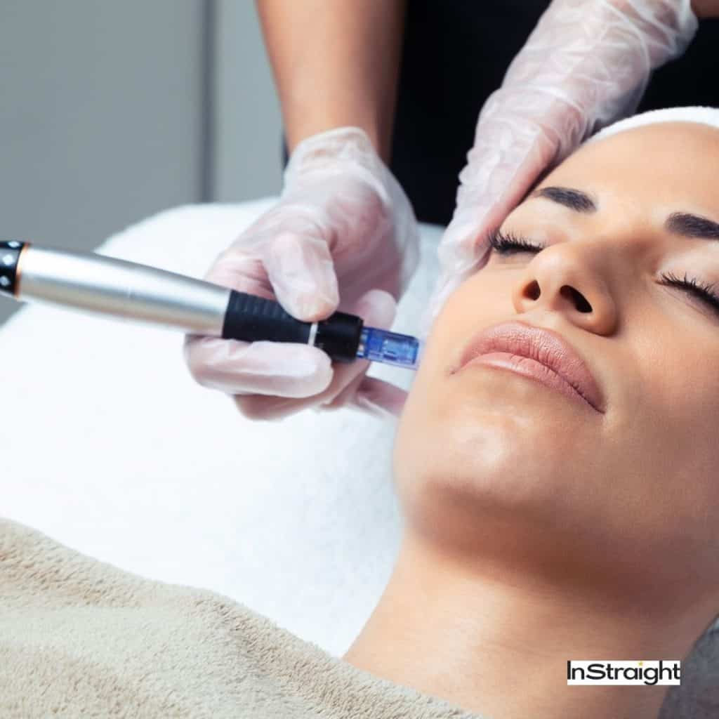 dermapen being used on the woman's face
